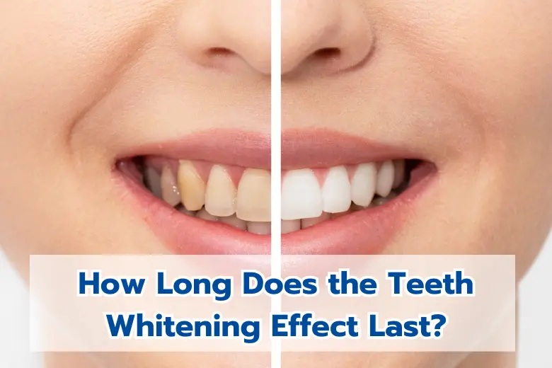 Before and after whitening