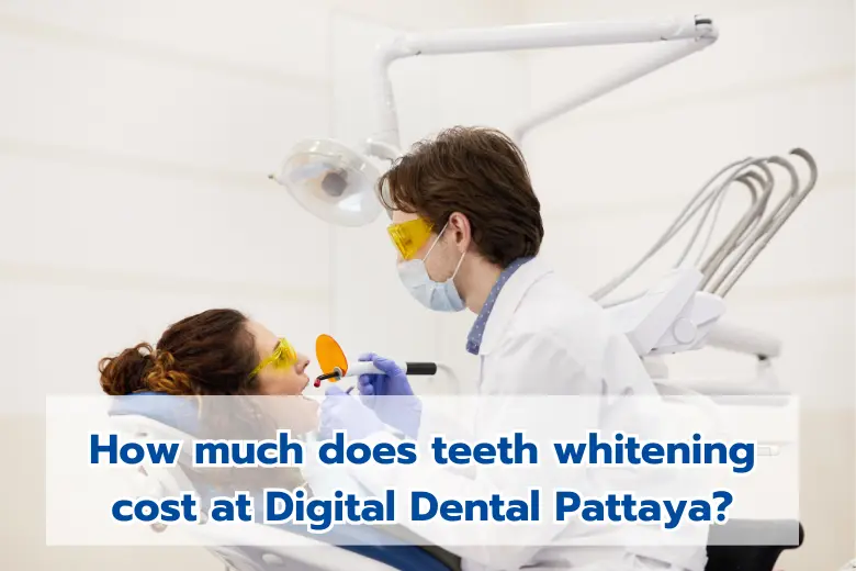 Consulting whitening costs