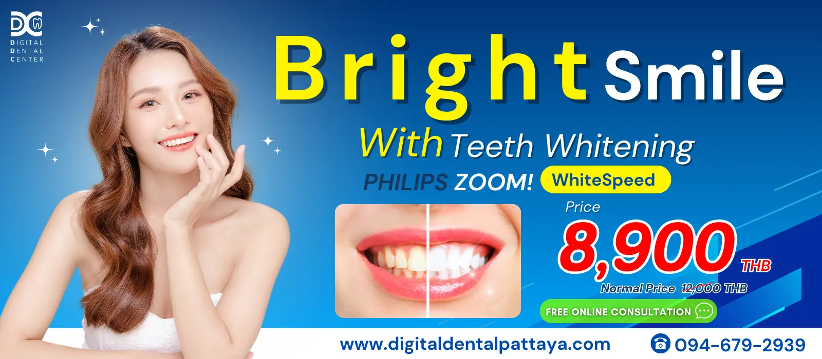 Teeth Whitening Promotion at Digital Dental Center Pattaya