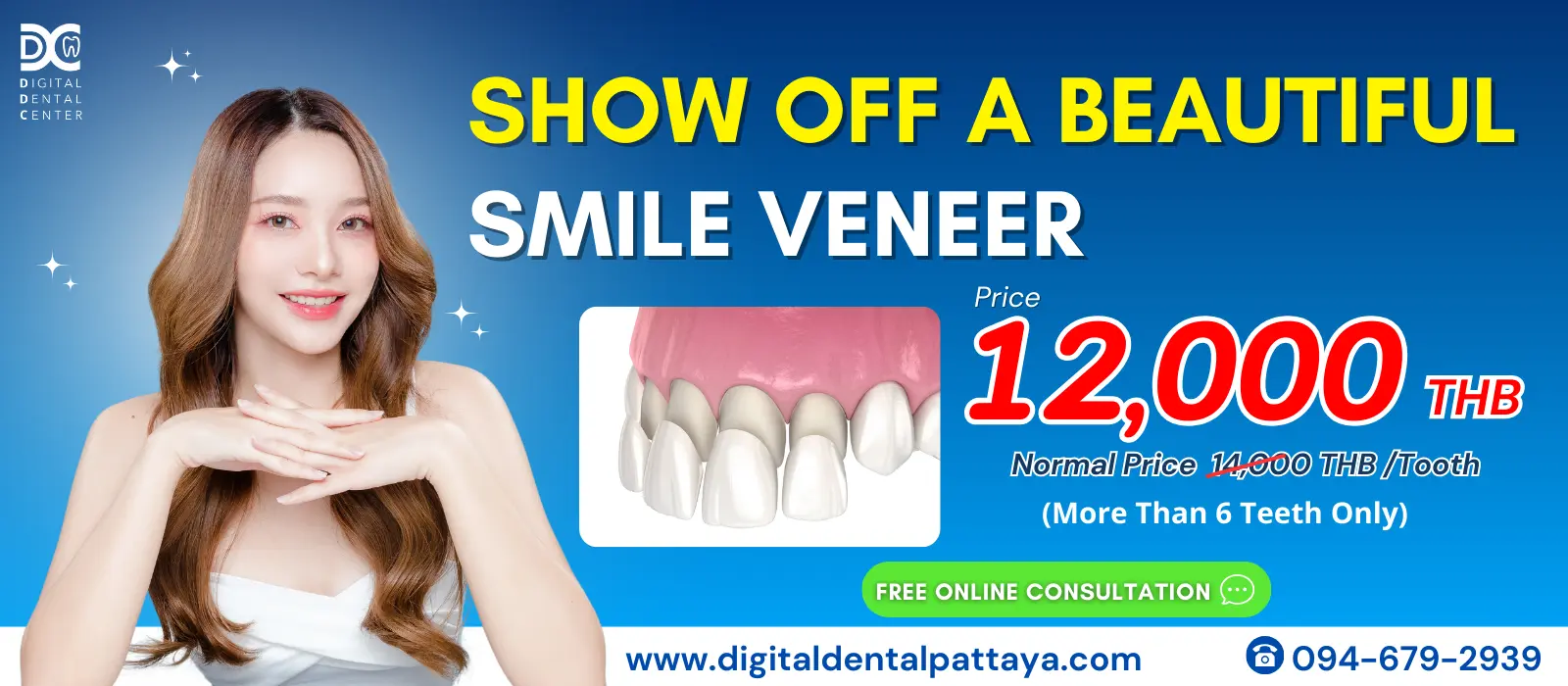 Veneer Promotion at Digital Dental Center Pattaya