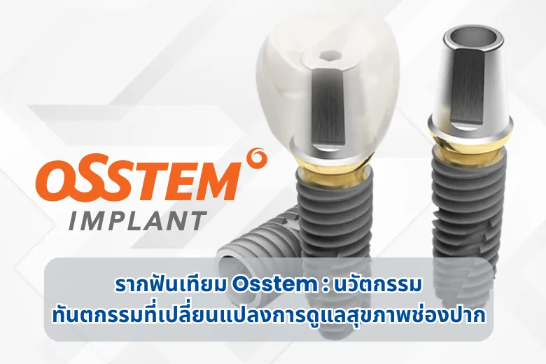 Close-up of Osstem dental implant components with branding.