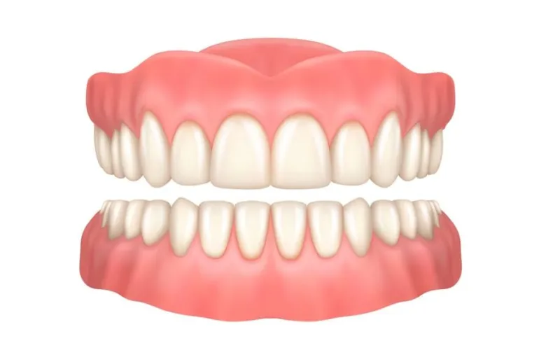 Illustration of full dentures