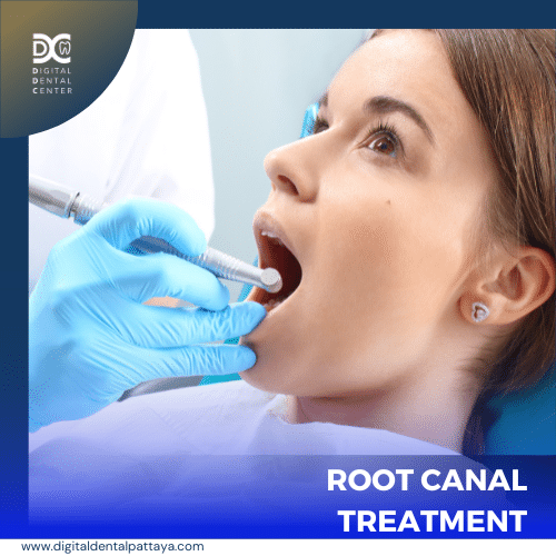 รักษารากฟัน Root canal Treatment