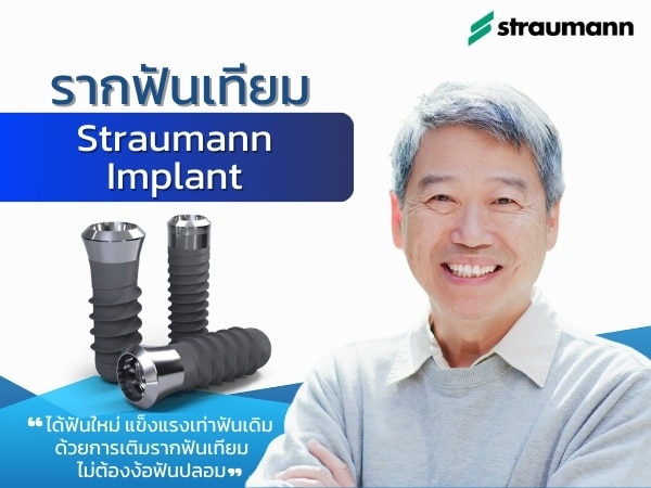 Strauman Implant