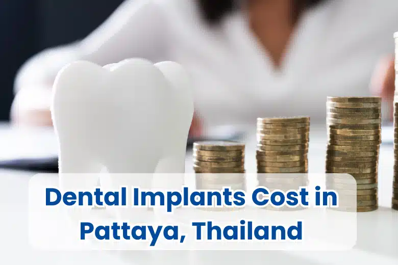 Dental-Implants-Cost in pattaya thailand