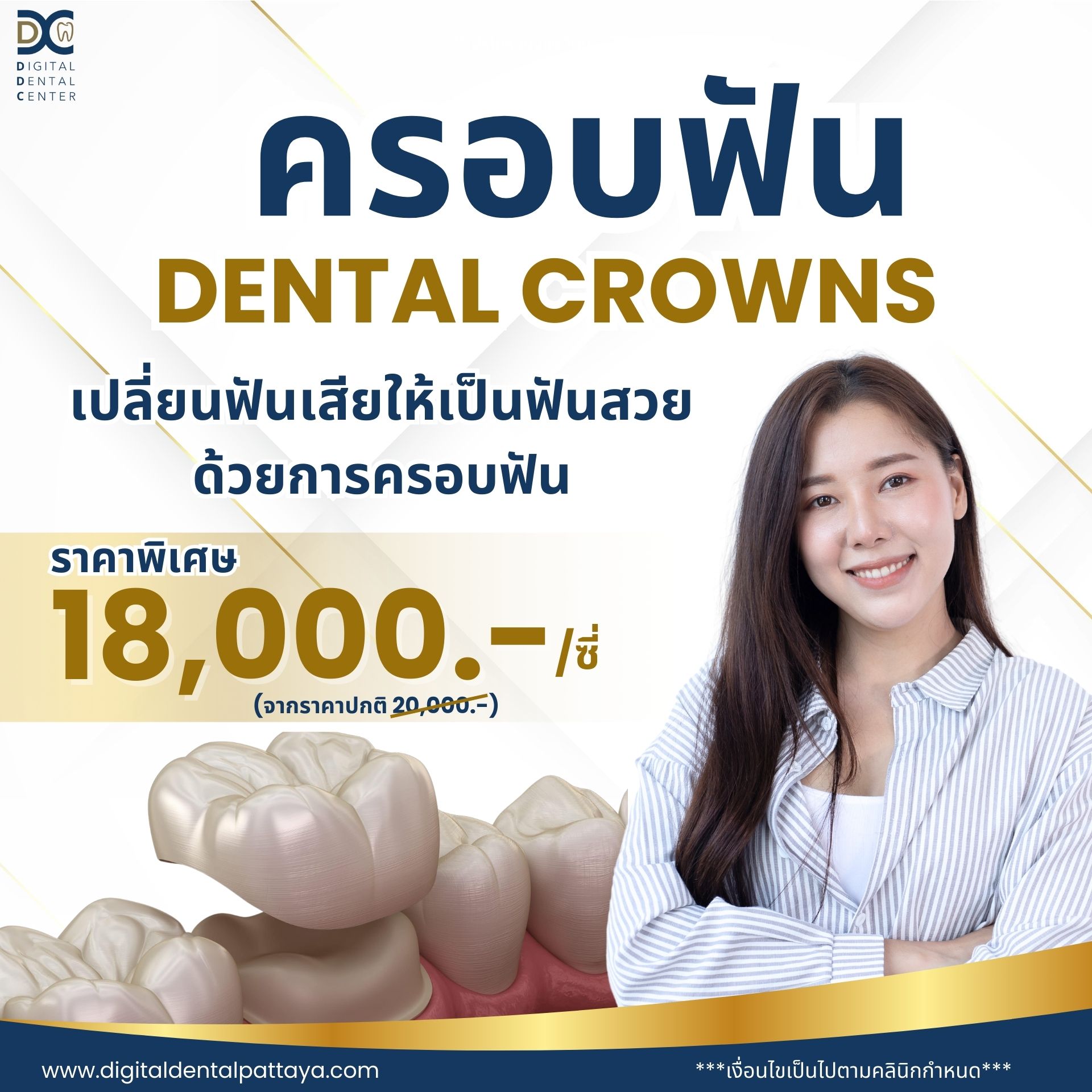 โปรโมชั่นครอบฟัน Dental Crowns